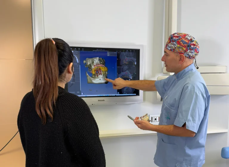 Glossario Implantologia - Come funziona un impianto dentale
